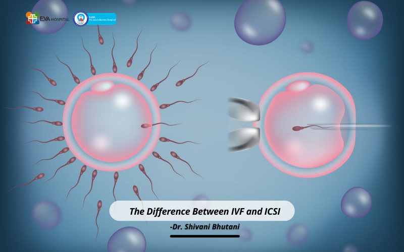 The Difference Between IVF and ICSI