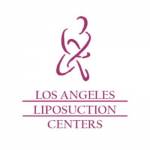 Los Angeles Liposuction Centers Profile Picture