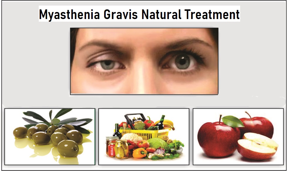 Simple and Effective Myasthenia Gravis Natural Treatments