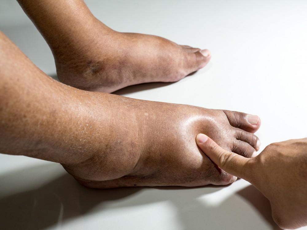Finding the Best Vascular Surgeon in Abu Dhabi: Your Guide to Diabetic Foot Care and Endovascular Surgery - WriteUpCafe.com
