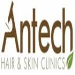 Antech hair Skin Clinics