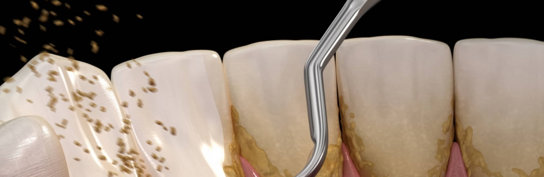 Avdental Surgerycenter Cover Image