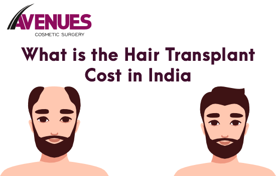 What is the Hair Transplant Cost in India? – Avenues Hair Translpant