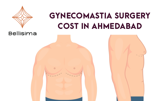 Gynecomastia Surgery Cost Ahmedabad | Gynecomastia Surgeon