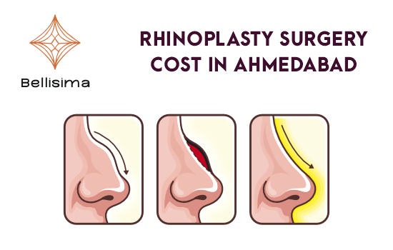 Rhinoplasty Cost in Ahmedabad | Nose Rhinoplasty Price India