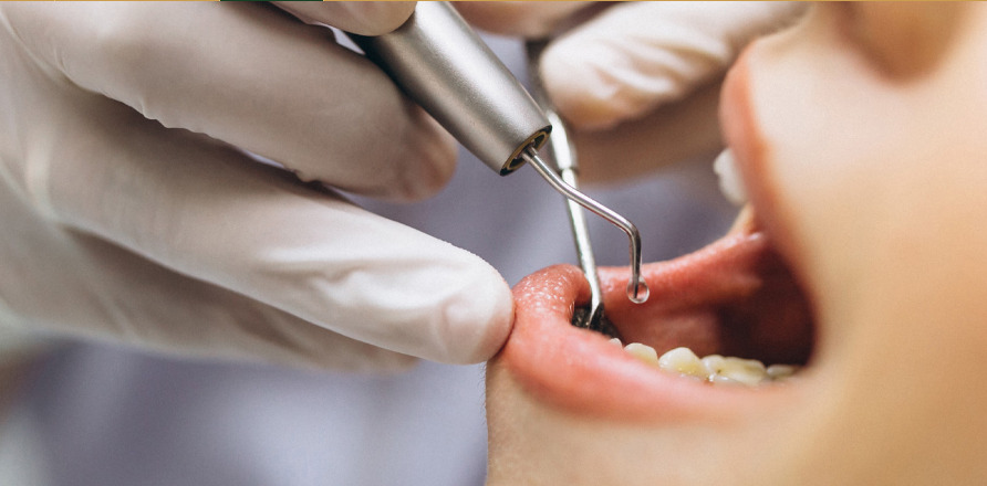 Understanding Root Canal Surgery: Procedure, Benefits, and Recovery - Shaper of Light