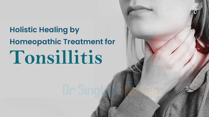 Get Homeopathic Medicines for Tonsillitis in India