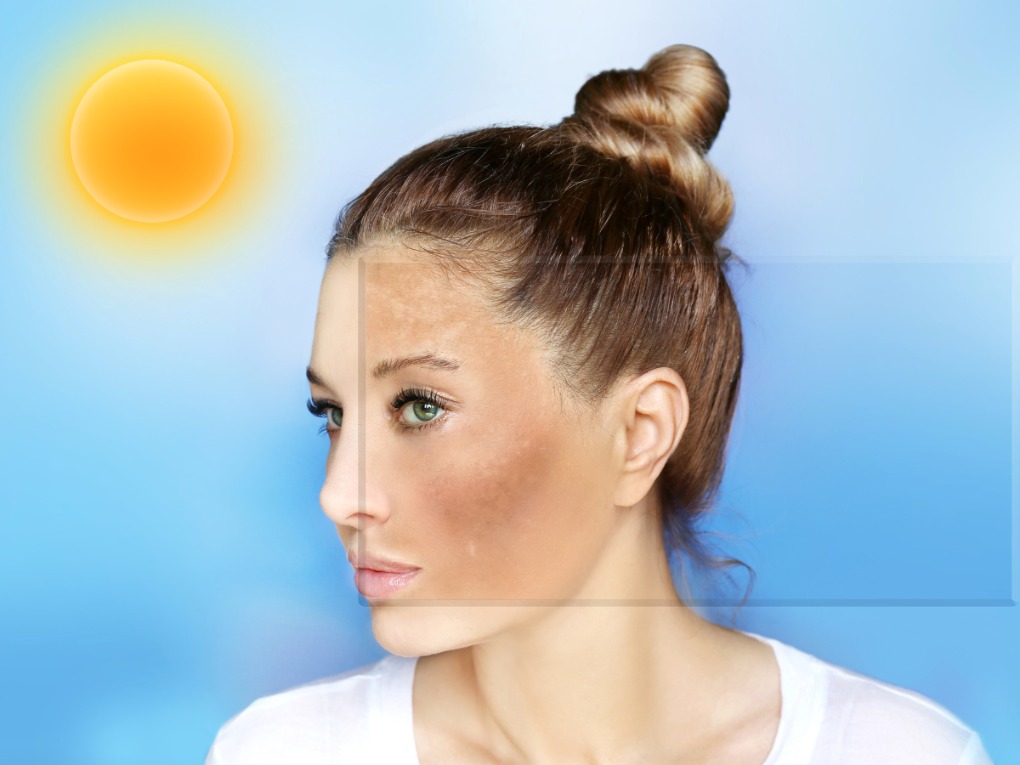 Reverse Sun Damage on Your Face: Effective Treatments & Tips | Vipon