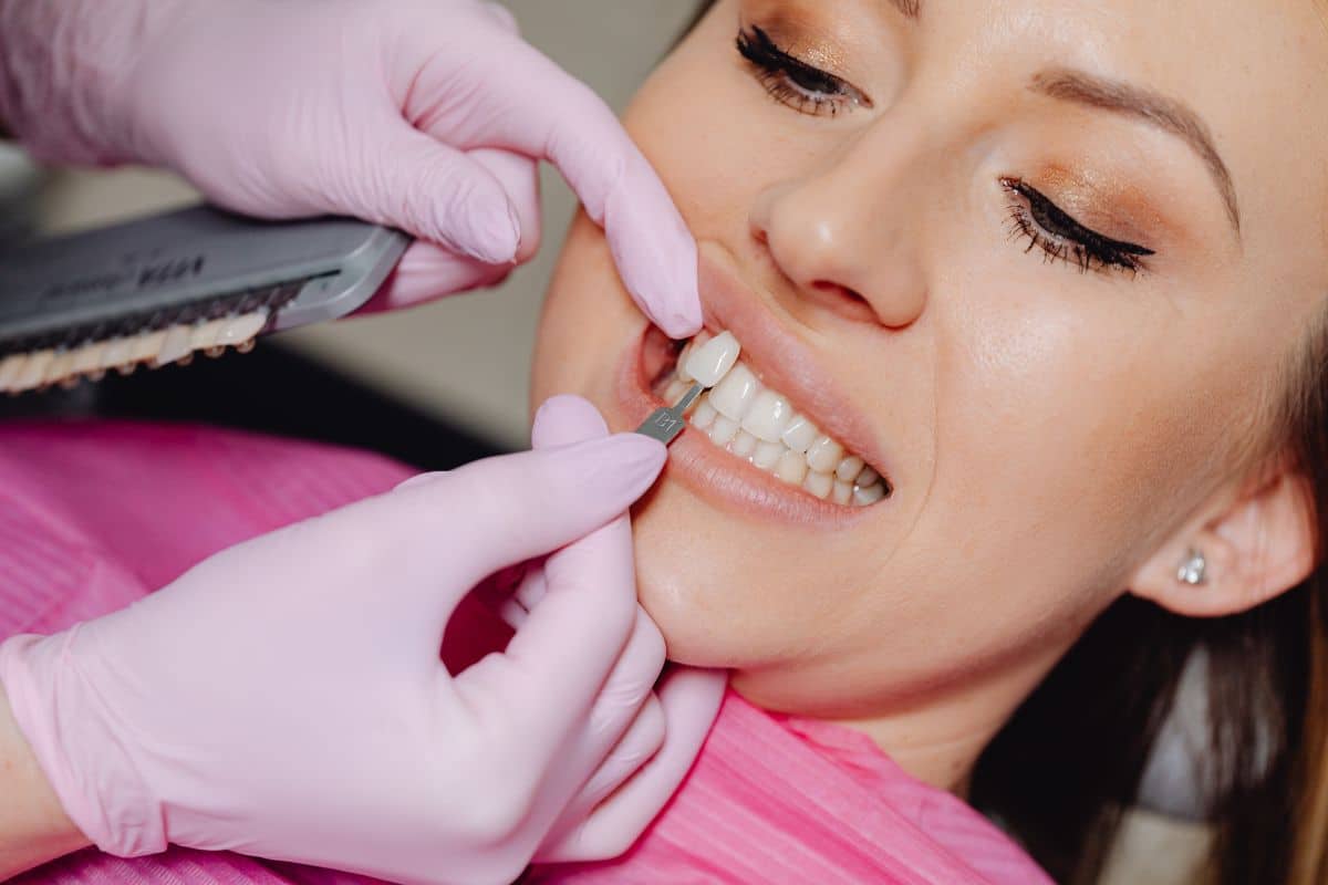 Understanding the Process of Getting Dental Veneers – Telegraph