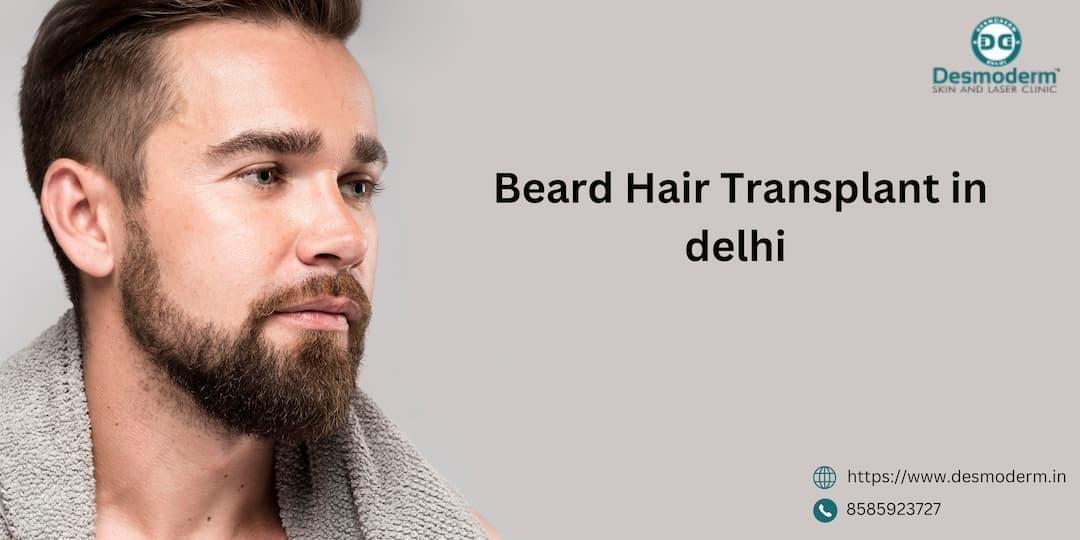 Transform Your Look: Beard Hair Transplant Essentials