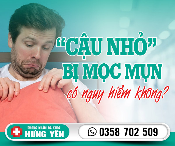 Bị mọc mụn ở cậu nhỏ: Nguyên nhân và cách điều trị hiệu quả