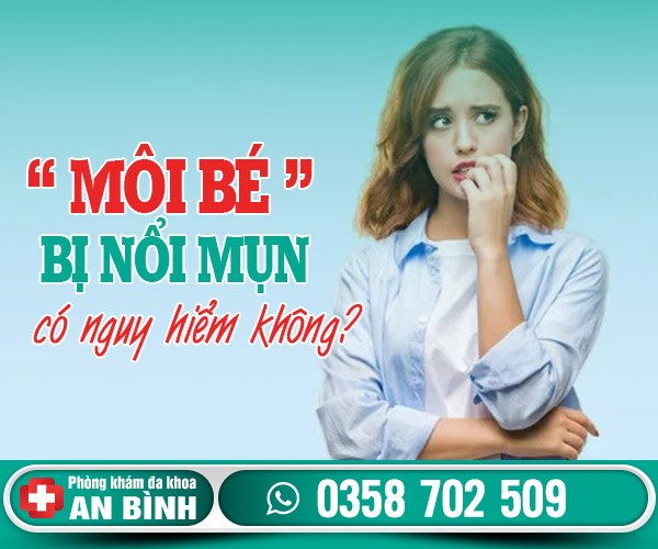 Môi bé bị nổi mụn có sao không?