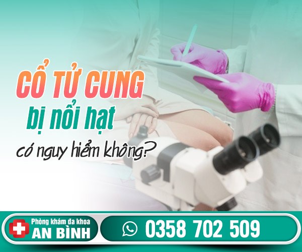 Cổ tử cung bị nổi hạt có sao không? Phải làm sao?