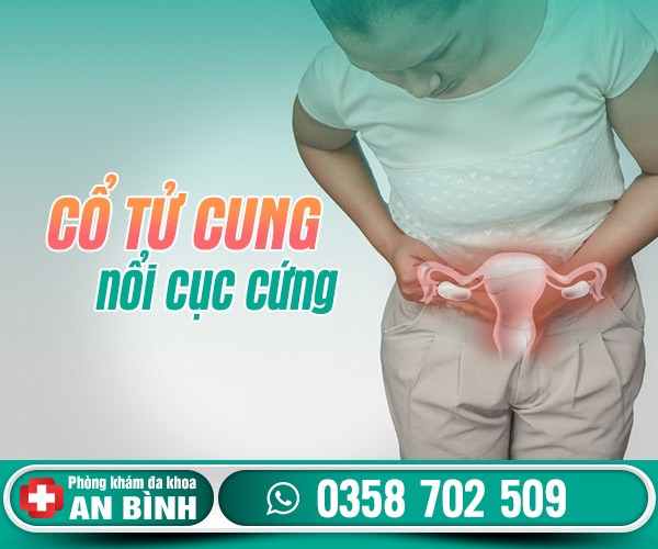 Cổ tử cung nổi cục cứng bị làm sao? - Phòng khám đa khoa Hưng Yên