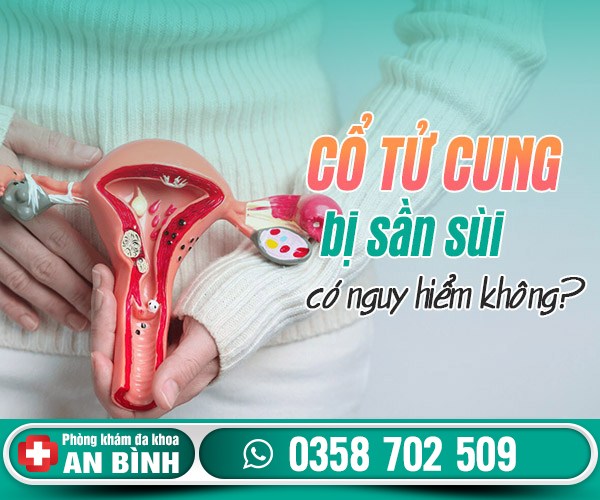 Cổ tử cung bị sần sùi có nguy hiểm không?